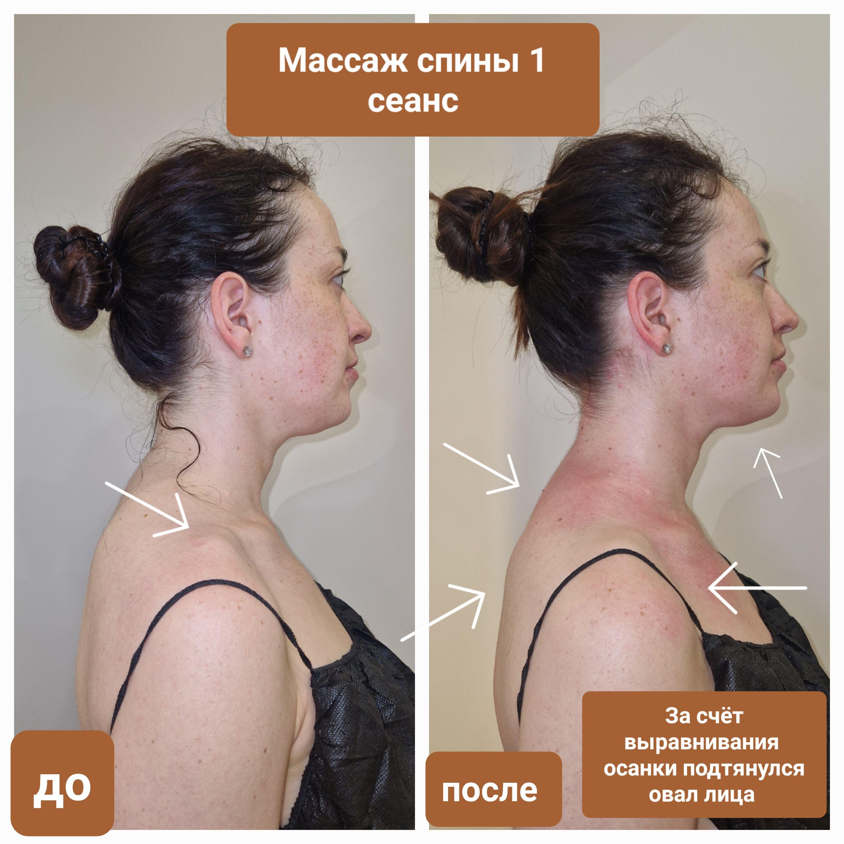 До и после массажа
