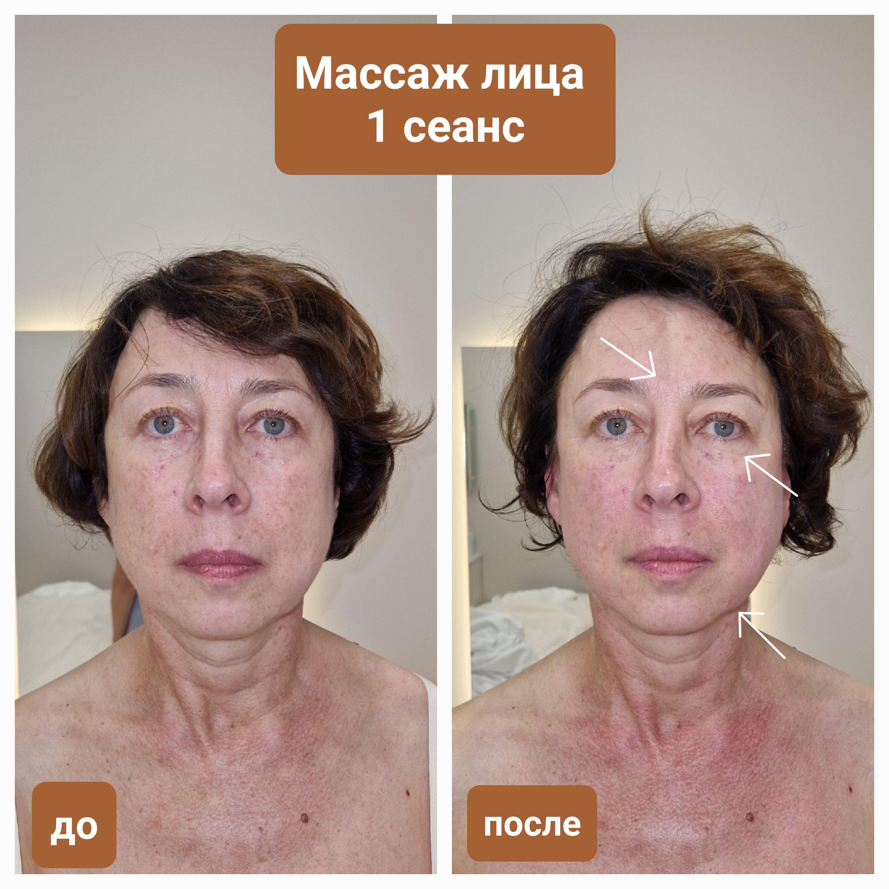 До и после массажа