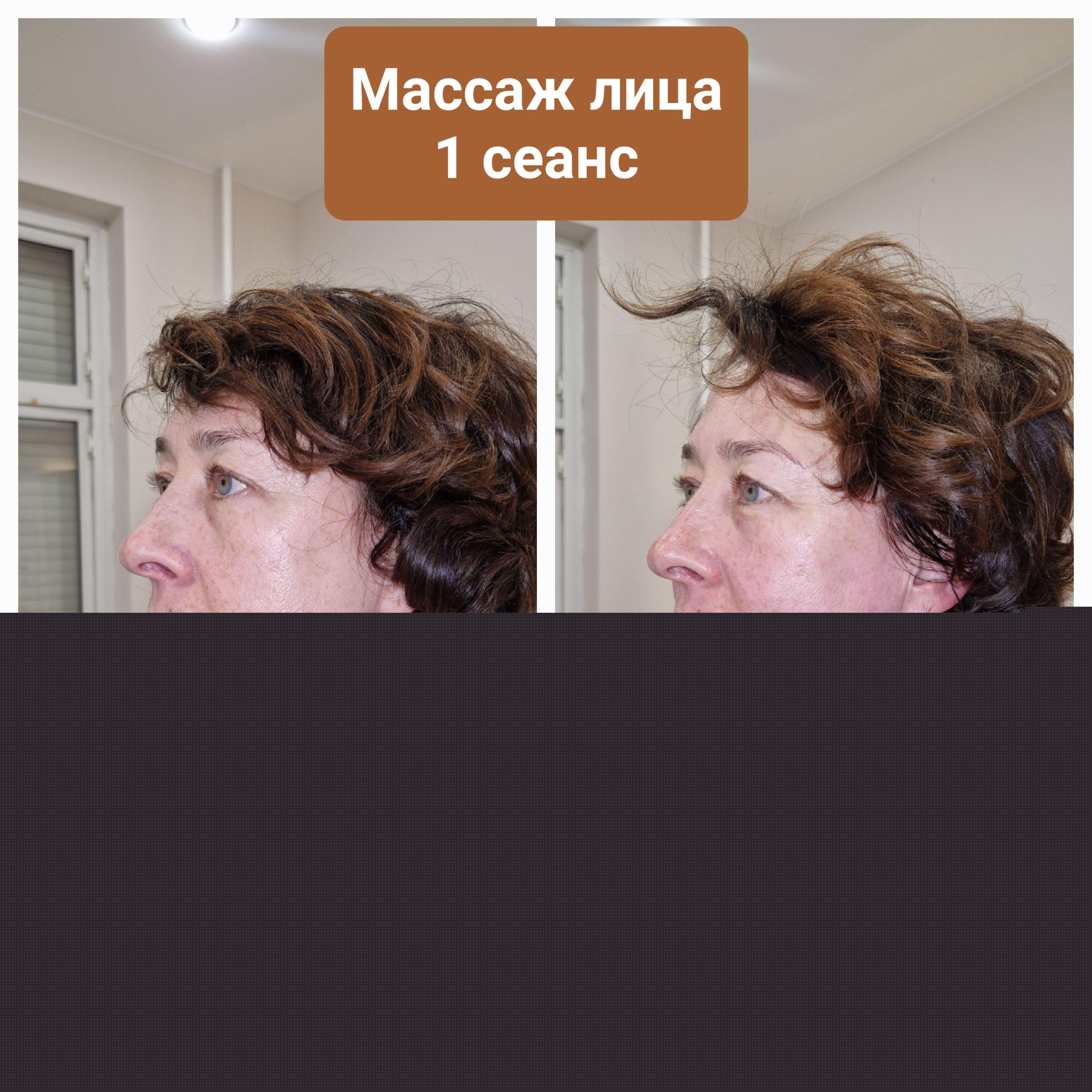 До и после массажа