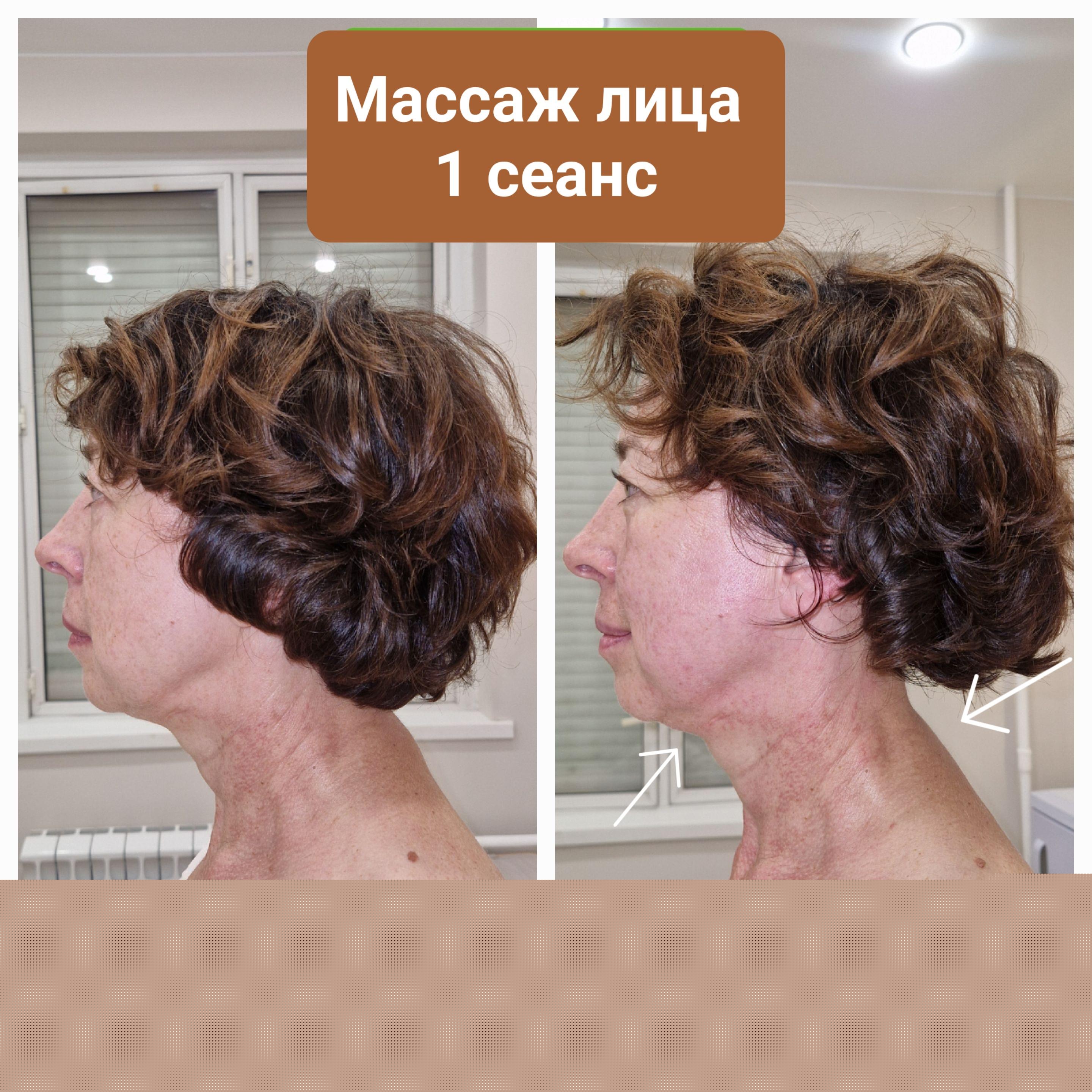 До и после массажа