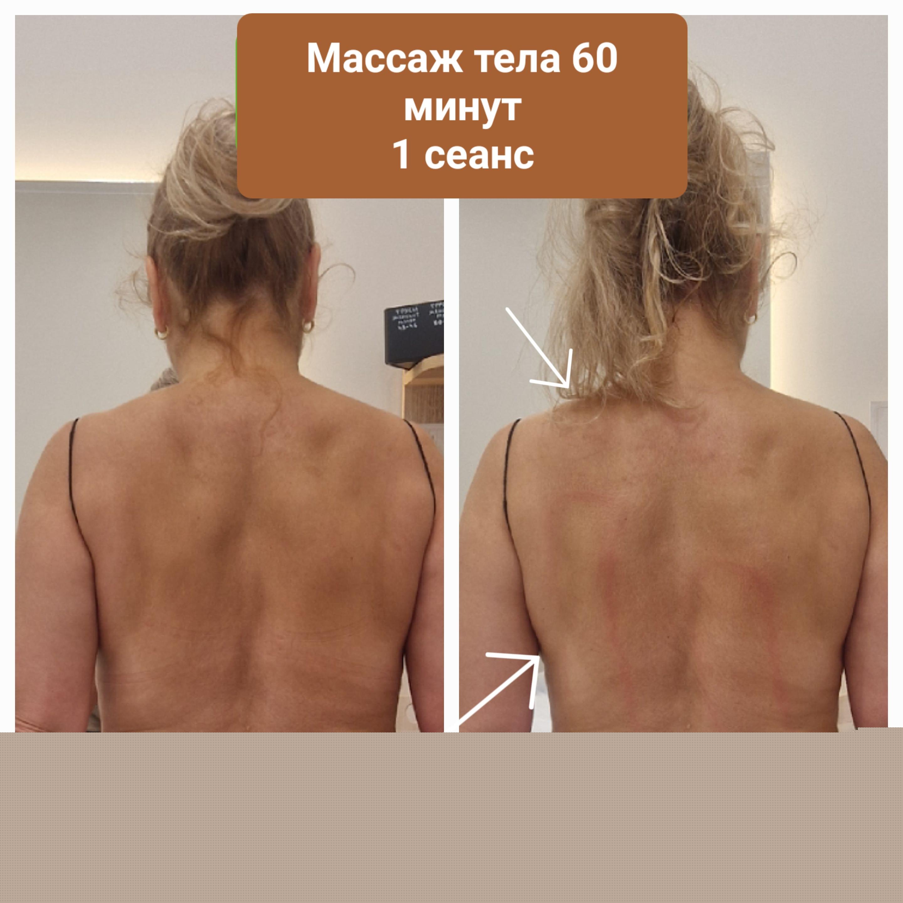 До и после массажа